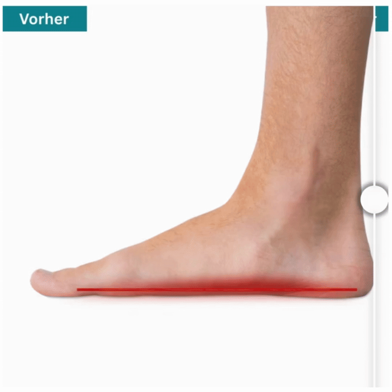 Experimenta la diferencia de Norelie con